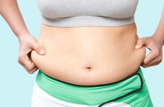 Tummy Tuck Specialist