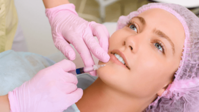 Dermal fillers