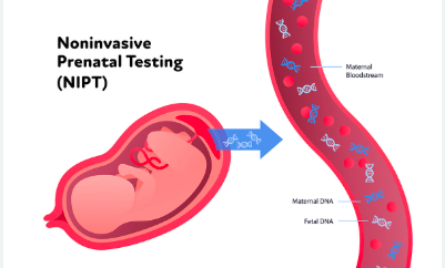 NIPT Test